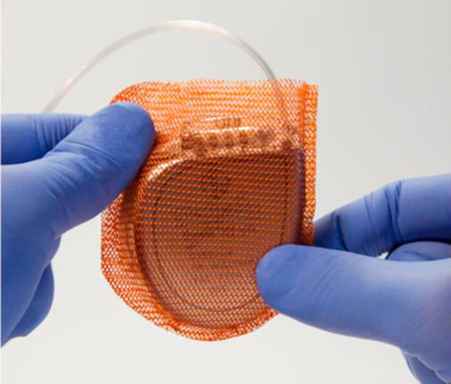 Colocación de Desfibrilador Automático Implantable (DAI):